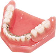 cast partial, dentures and partials, Amarillo TX